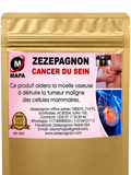 Cancer du Sein