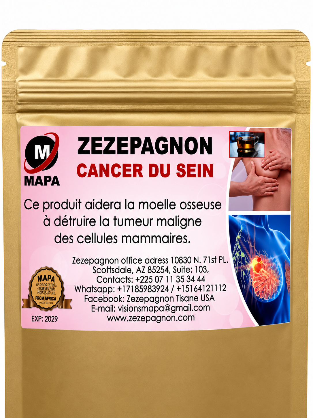 Cancer du Sein